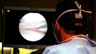 Dr Robert Eppley  Arthroscopic Knee Surgery  Video 1 [upl. by Vivia]