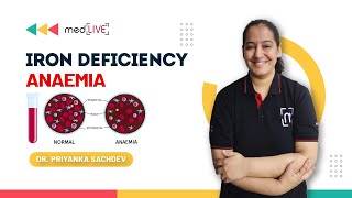 Iron Deficiency Anaemia  Etiology  Stages  Treatment by Dr Priyanka Sachdev  Medlive [upl. by Fabrianna856]