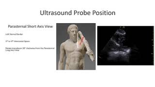 Basic Transthoracic Echocardiography Cardiac Ultrasound  TTE Made Simple [upl. by Cailean]