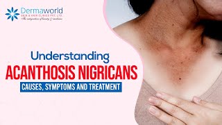 Understanding Acanthosis Nigricans Causes Symptoms and Treatment [upl. by Ayotel]