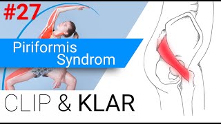 Piriformis Syndrom erklärt  Überlastung der Hüftaussenrotatoren [upl. by Asenab213]