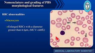 Red Blood Cells Morphology Peripheral Blood Smear Part01 [upl. by Acireit440]