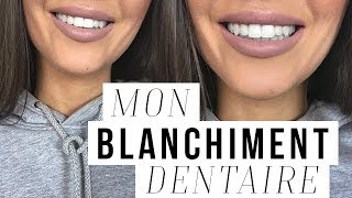 COMMENT JAI BLANCHI MES DENTS  MON BLANCHIMENT DENTAIRE [upl. by Miru]