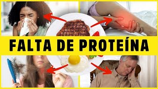 11 SINAIS de FALTA DE PROTEÍNA que VOCÊ NUNCA Imaginou Podem Arruinar sua Saúde Dr Alain Dutra [upl. by Carr775]