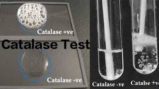 Catalase Test [upl. by Adnilrem]