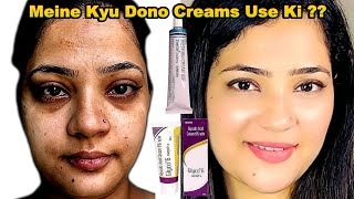 Glyco 6 vs Tretinoin Why I Decided to Use Both for Maximum Results  Indian Youtuber Anmol [upl. by Benkley]