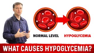 What Causes Hypoglycemia – DrBerg [upl. by Celka174]