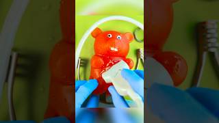 Gummy Surgery Fail😩💔🪦Satisfying Csection flatline DiscountDentist FruitSurgery FoodSurgery [upl. by Nocam670]