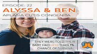 Alyssa and Ben Aplasia Cutis Congenita and Intellectual Disabilities [upl. by Ardelis250]