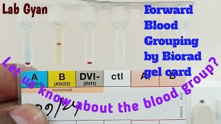 Forward Blood Grouping by Gel Card Method [upl. by Weinman]