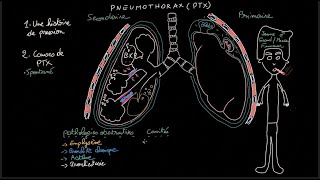 Pneumothorax  Docteur Synapse [upl. by Blanche]