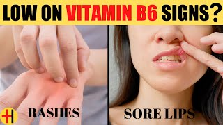 Vitamin B6 Pyridoxine Deficiency Symptoms  Signs You Have Vitamin B6 Deficiency [upl. by Annaerdna]