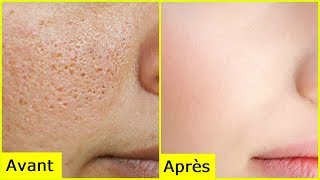 Pore dilatés  solution maquillage efficace pour toute la journée [upl. by Wernick]