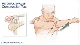 Acromioclavicular Compression Test  Chiropractic Online CE™ [upl. by Ayhay]