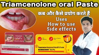 Kenacort 01  Kenacort gel how to use  Triamcinolone oromucosal paste bp 01 ww [upl. by Longwood]