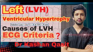 Left Ventricular Hypertrophy Left Ventricular Hypertrophy ECGCauses of LVH DrKashan QasitECGEKG [upl. by Yrevi]