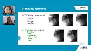 Replay Webinaire  Prise en charge des troubles de la déglutition en cas de maladies neurologiques [upl. by Adnilasor149]