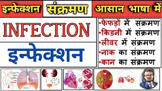 Infection  Classification of Infection  Hospital Acquired Infection  noshocomial infection [upl. by Marya925]