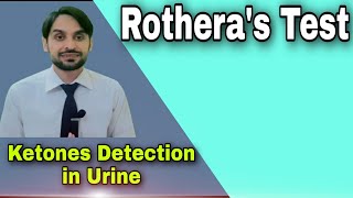 Rotheras Test  Ketone Bodies Detection in Urine [upl. by Idnem539]