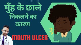 मुँह के छाले होने का कारण । Causes of Mouth Ulcer  Aphthous [upl. by Ula520]