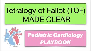 8 mins Tetralogy of Fallot TOF MADE CLEAR by Pediatric Cardiology PLAYBOOK [upl. by Onailimixam]