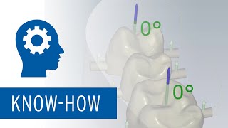 Ceramill Match 2  New software design [upl. by Ecahc398]