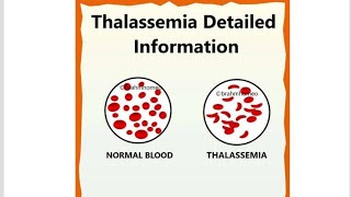 Thalassemia and Classifications of Thalassemia [upl. by Inaffit]