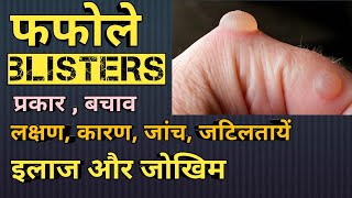 फफोला तरल पदार्थ से भरा हुआ त्वचा का एक उभार  Blisters explained in Hindi  Medhealth support [upl. by Irma127]