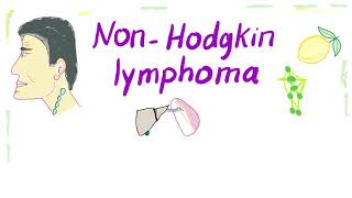 NonHodgkins lymphoma NHL Bcell and Tcell  Aggressive and Indolent [upl. by Carlo]