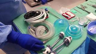 BASIC SET UP LAP CHOLECYSTECTOMY [upl. by Ecirtnuahs68]