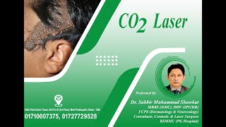 CO2 Laser on Skin Tumour Nevus Sebaceous  Skin Square  Dr Sabbir Muhammad Shawkat [upl. by Gilchrist483]