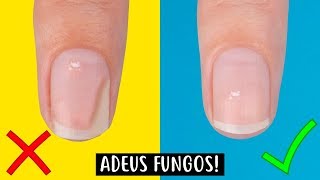 COMO ACABAR COM FUNGOS DE UNHAS  RAPIDAMENTE [upl. by Elyrpa]