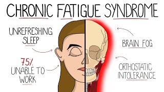 Myalgic Encephalomyelitis Chronic Fatigue Syndrome  Includes Criteria amp Treatment [upl. by Ellednahc]