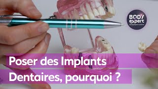 SOINS DENTAIRES  🦷Poser des Implants Dentaires pourquoi   BODYEXPERT [upl. by Yerffe]