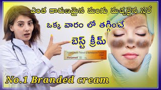 Melamet cream uses in telugu  best cream for melasma  skinshine cream  మంగు మచ్చలు [upl. by Nirre935]