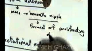 GENITAL 6 fibrocystic disease amp breast cancer DR SAMEH GHAZY [upl. by Faria]