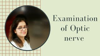 Clinical examination of 2nd Cranial nerve Optic nerve [upl. by Arevle]