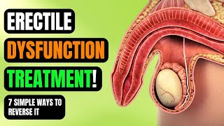 Erectile Dysfunction Treatment  7 Simple ways to Reverse it  Watch This  Self Care [upl. by Ev]