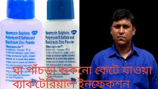 Neosporin powder use in bengali2021 [upl. by Tiemroth]