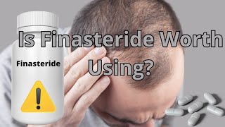 Finasteride For Hair Loss Is It Worth Using It Learn What You Need About Finasteride [upl. by Nyar]