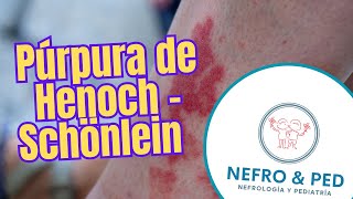 Púrpura de Henoch  Schönlein  Vasculitis por IgA  purpuradehenoch vaculitisleucocitoclastica [upl. by Nirot396]