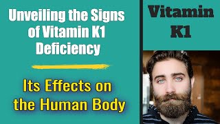 Unveiling the Signs of Vitamin K1 Deficiency A Comprehensive Guide [upl. by Ayisan]