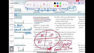 Systolic Aortic Stenosis Murmur cardiology 35  First Aid USMLE Step 1 in UrduHindi [upl. by Ackerman]