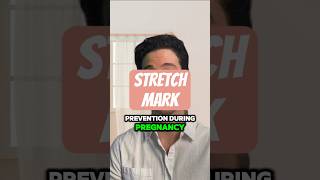 Stretch Mark Prevention During Pregnancy From A Dermatologist shorts pregnancytips [upl. by Aryad]