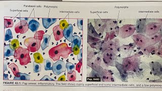 The Science of Cytological Stains How They Work Revealed  HampE  Papanicoloau stain [upl. by Irita]