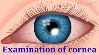 Examination of Cornea with 9 important points  corneal abnormalities amp disease  structure cornea [upl. by Einaled903]