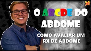 COMO AVALIAR RAIO X ABDOME  O ABCDE DO ABDOME I VOCÊ RADIOLOGISTA [upl. by Aicenad]