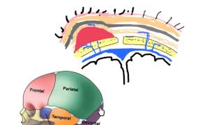 scalp hematomas in neonates [upl. by Maiga]