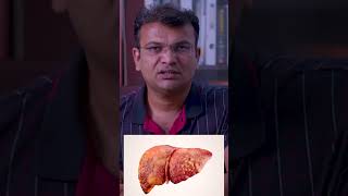 Fibroscan करते कब है और कैसे  fibroscan fibroscantest fibroscanliver fibroscandevice [upl. by Siraf]