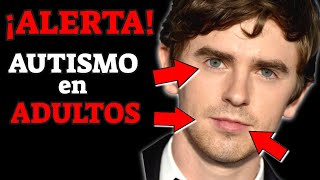 SINTOMAS de ALERTA de AUTISMO en ADULTOS que NO DEBES IGNORAR SINDROME DE ASPERGER [upl. by Giacinta]